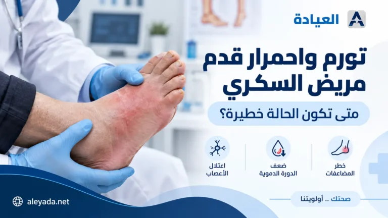 طبيب يفحص قدم مريض سكري تعاني من تورم واحمرار داخل عيادة طبية